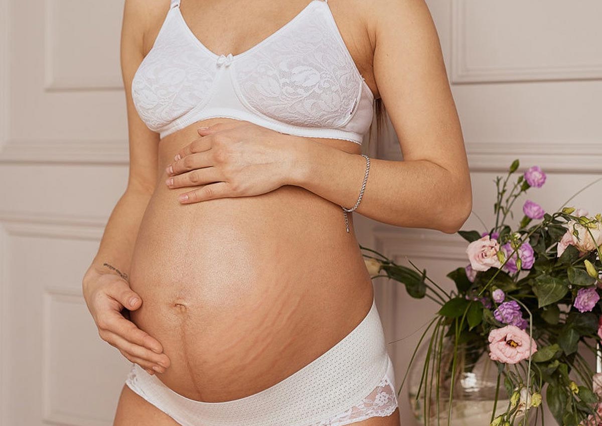 Растяжки во время беременности