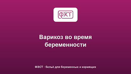 Варикоз во время беременности